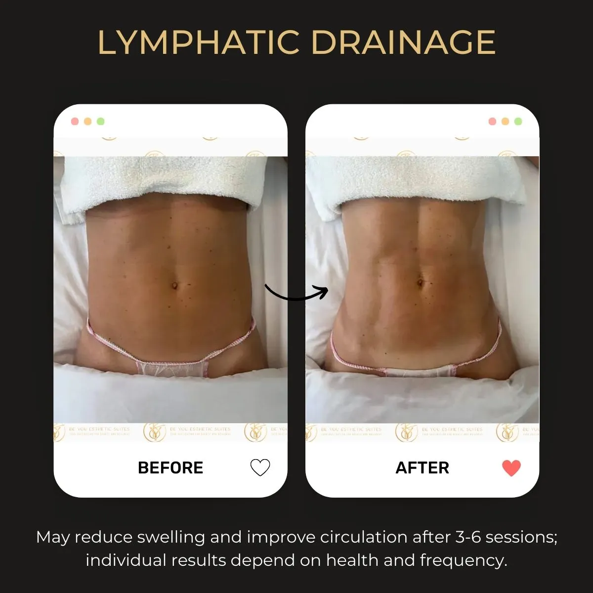 Manual lymphatic drainage before and after — Be You Esthetic Suites.