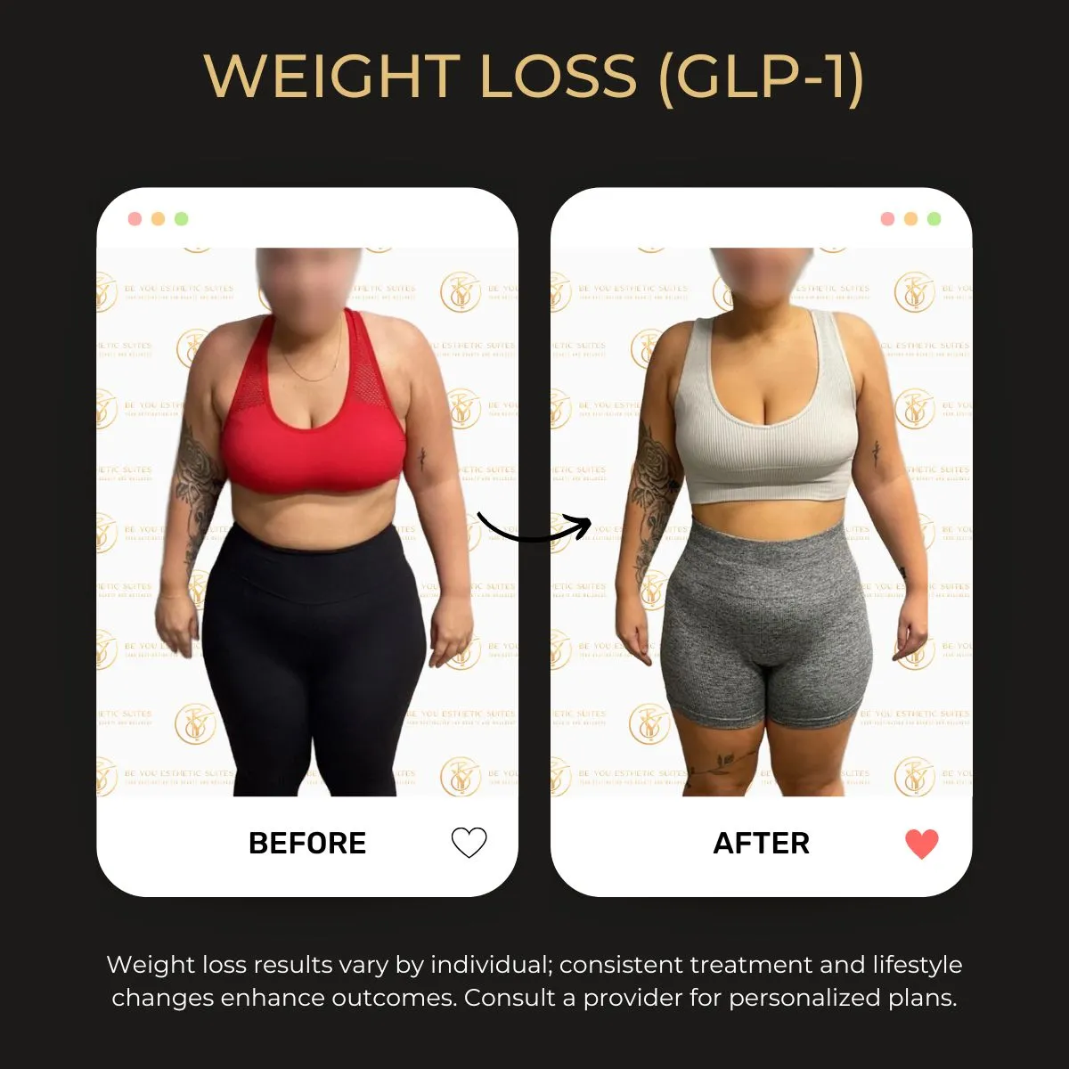Weight loss program before and after — Be You Esthetic Suites.