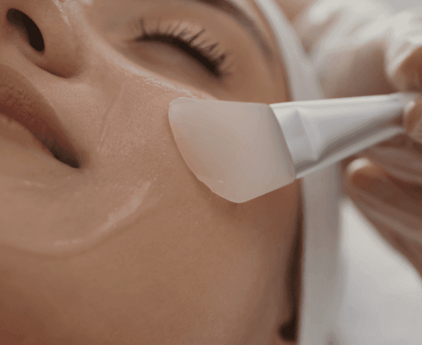 Chemical peels at Be You Esthetic Suites.