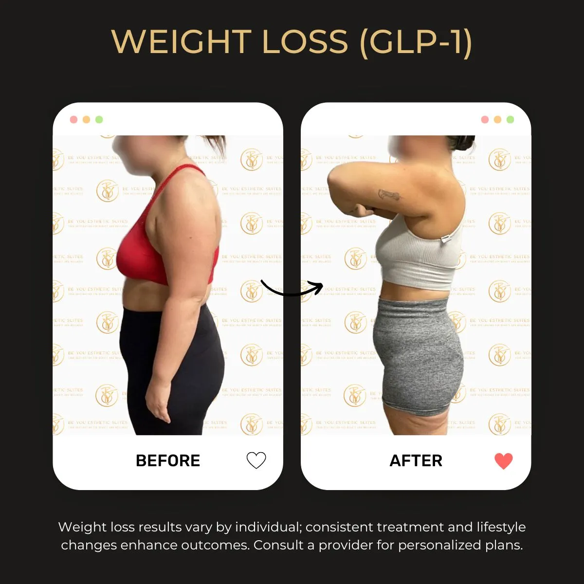 Weight loss before/after 1.