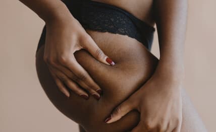 Frustrated with stubborn fat — ultrasonic cavitation solution.